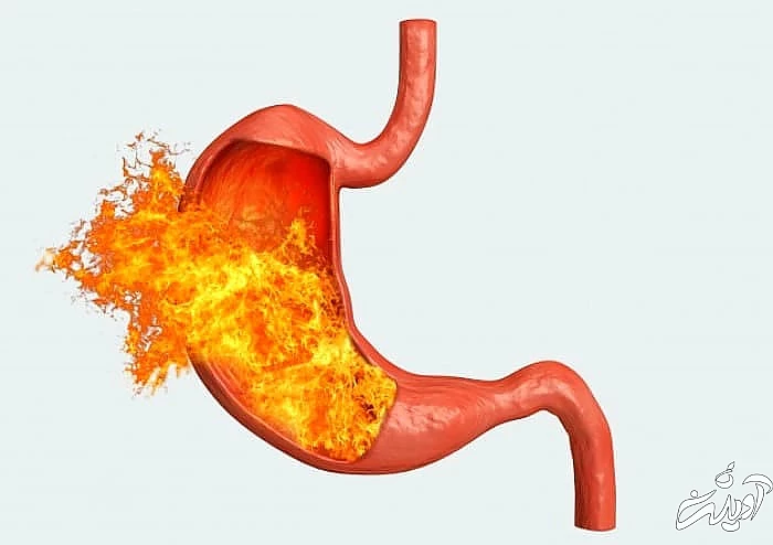 مضرات سرپا نوشیدن آب سوزش معده